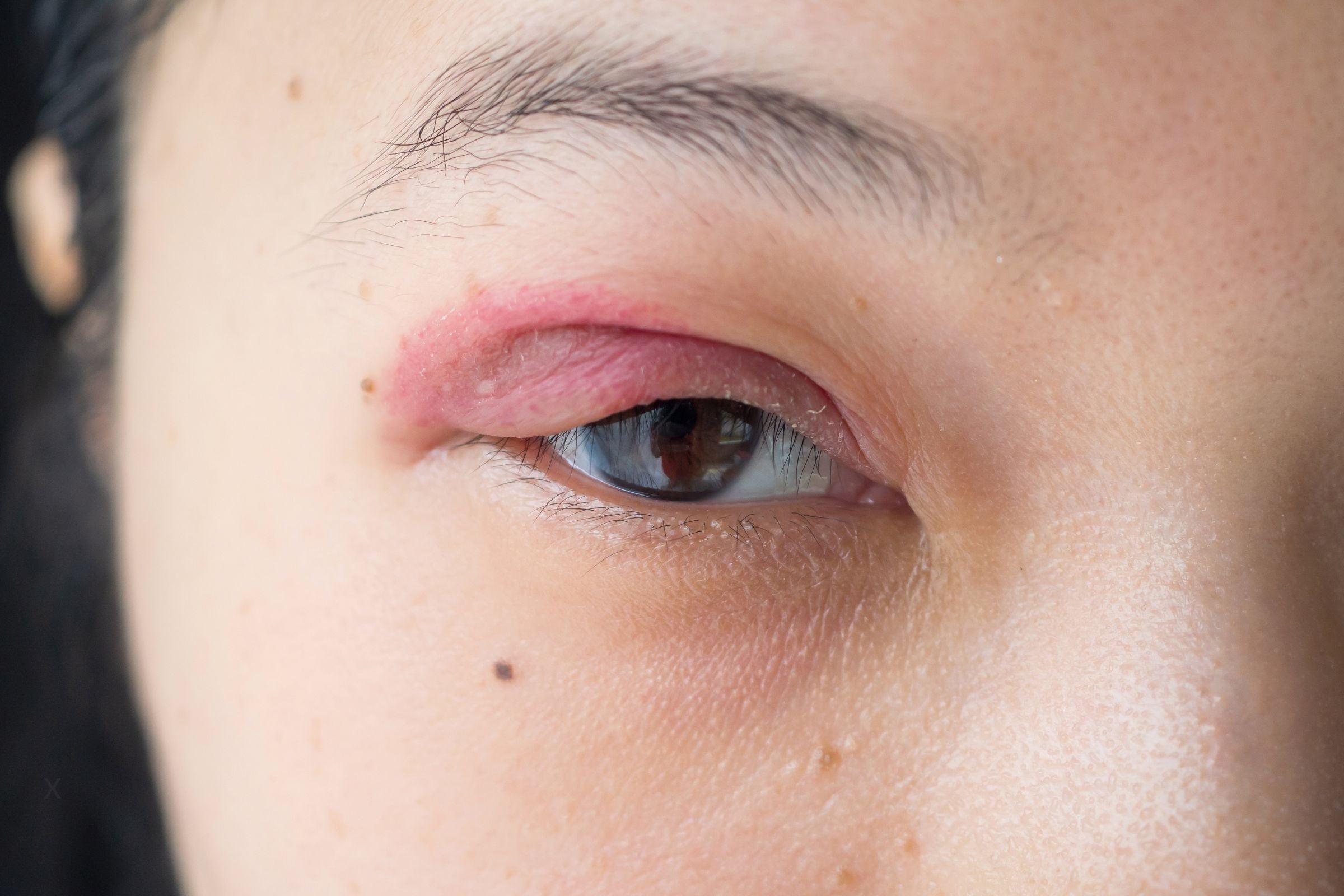 When Cheap Skincare Comes at a Cost – What You Need to Know