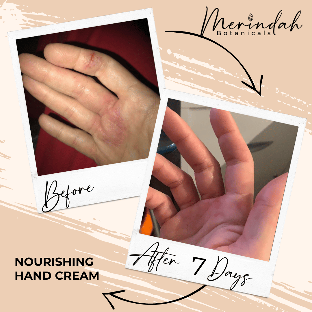 Images feature a hand with dry skin before and after using the product. The "Before" image displays red, dry skin, while the "After 7 Days" image shows noticeably smoother and healthier-looking skin. In the background, text highlights Merindah Botanicals&